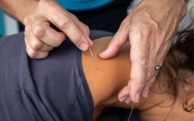 Dry Needling and Acupuncture, Whats the difference?