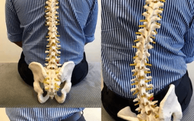 Why sitting on your wallet is bad for your back
